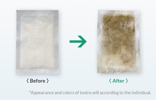 Before After *Appearance and colors of toxins will acording to the individual